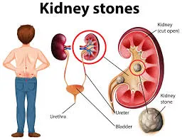 Best Urologist in Kapurbawadi Thane
Urologist in ...