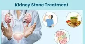 Best Urologist in Kolbad Road Thane
Urologist in ...