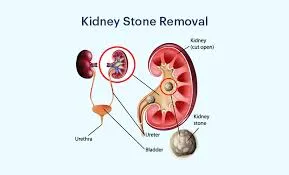 Best Urologist in Kolshet Thane
Urologist in Kols...