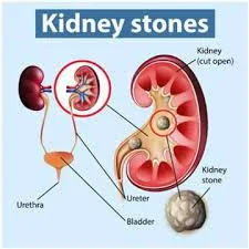 Best Urologist in Vasant Vihar Thane
Urologist in...