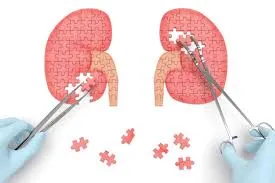 Kidney Stone Removal in Thane West
Kidney Stone Re...