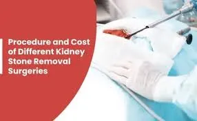 Urologist Doctors in Thane
Best Urologist Doctors...