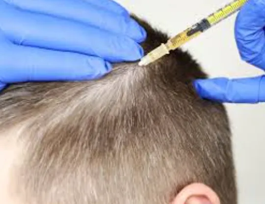 Hair Rejuvenation Treatment at TRu Aesthetics Prem...