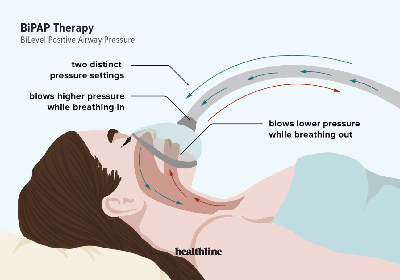 Setting up a Bi Pap Machine
Setting up a BiPAP (B...