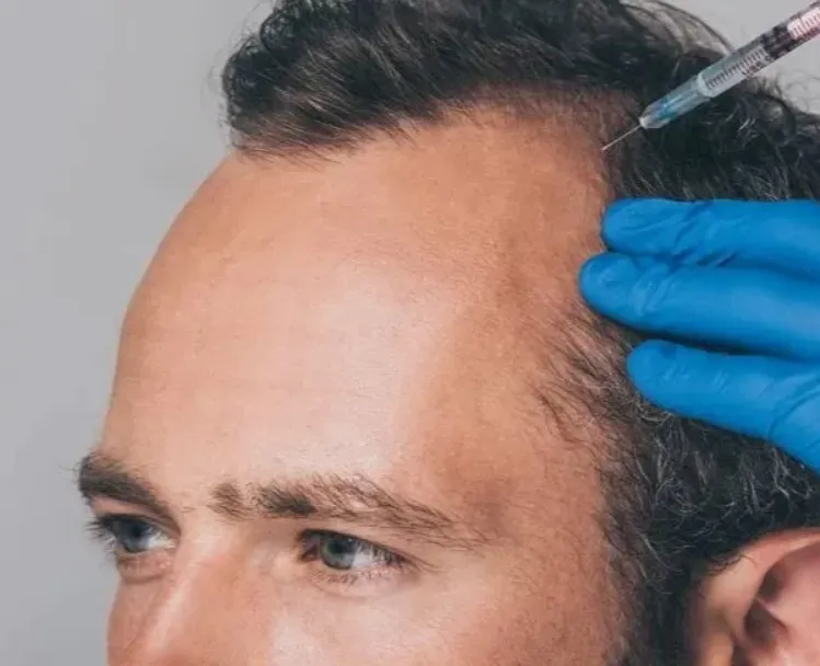 PRP Therapy for Hair Benefits at TRu Aesthetics Di...