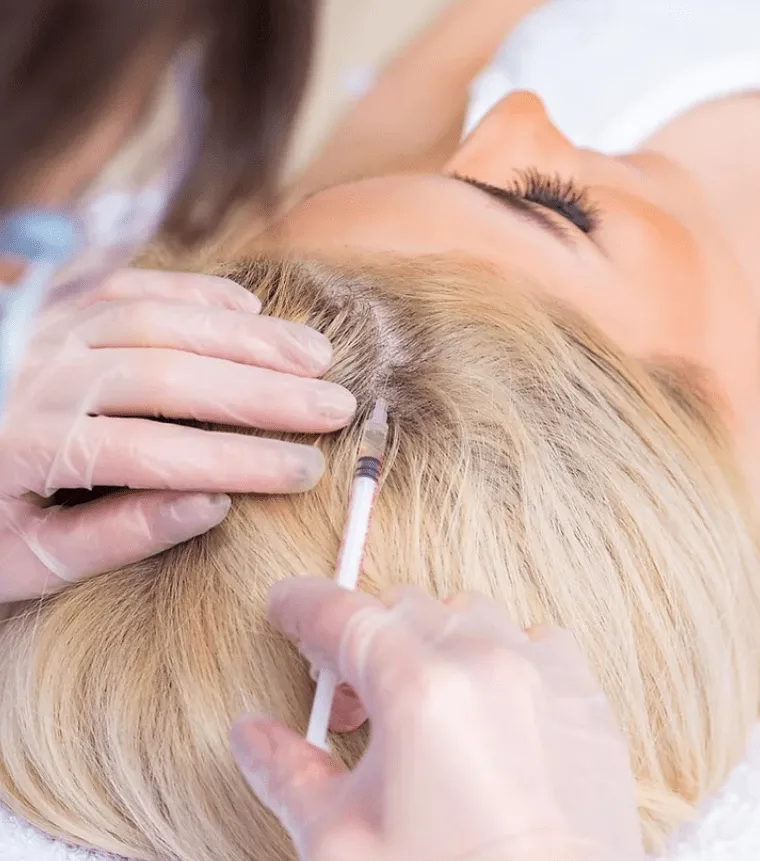 PRP Therapy for Hair at TRu Aesthetics PRP Therapy...
