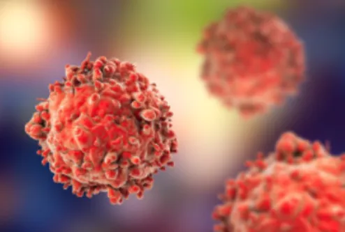 Specialized Care for Leukemia and Lymphoma by Dr. ...
