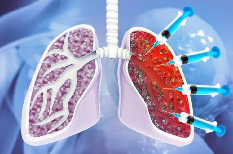 Pediatric Pulmonologist Near Me - Galaxy Chest and...