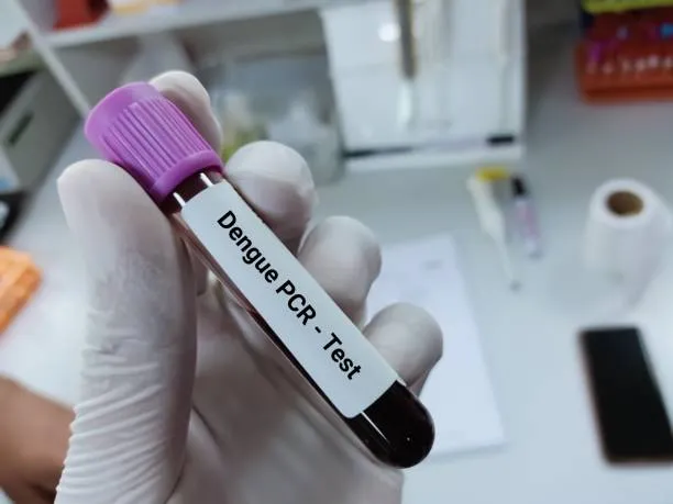 Dengue Fever : Symptoms, Prevention and Control De...