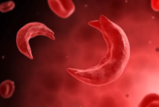 Hemoglobinopathy Treatment with Dr. Atish Bakane i...