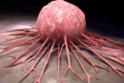 Pediatric Solid Tumors - Expert Care by Dr. Atish ...