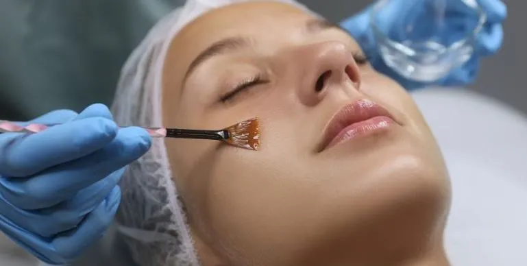 Rejuvenate Your Skin with Chemical Peeling at Gind...