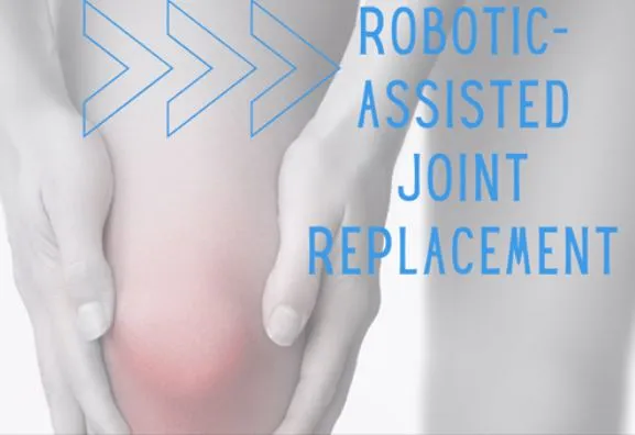 Advanced Robotic Joint Replacement Surgery in Nash...