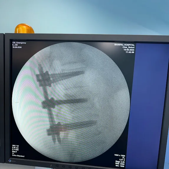 Best Spine Surgeon in Pune | Best Spine Doctor in ...