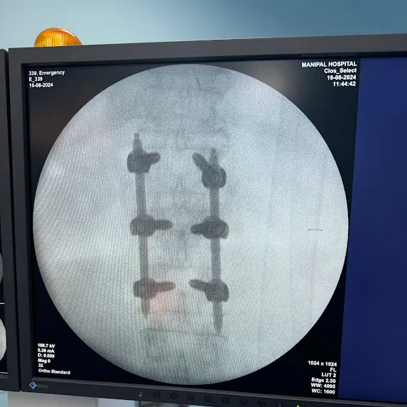 Do you need Spine Surgeon ? Spine Specialist? Spin...