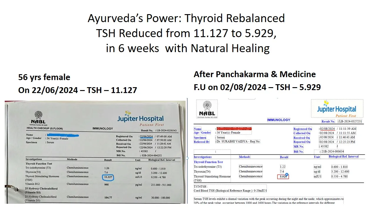 Ayurveda’s Power: Thyroid Rebalanced
TSH Reduced ...
