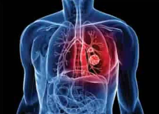 Best Thoracic Surgery in Nagpur Thoracic Surgery a...