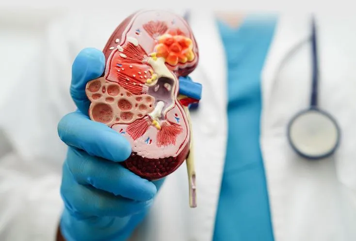 Comprehensive Kidney Disease Management in Thane E...