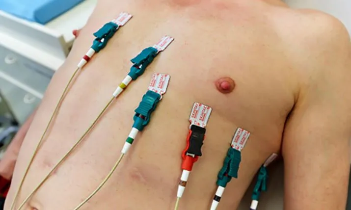 Accurate ECG Testing at SR Heart Clinic in Chennai...