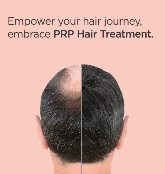 Best PRP Therapy for Hair in Pune Natural Hair Res...