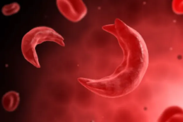 Hemoglobinopathy Specialist in Nagpur Hemoglobinop...