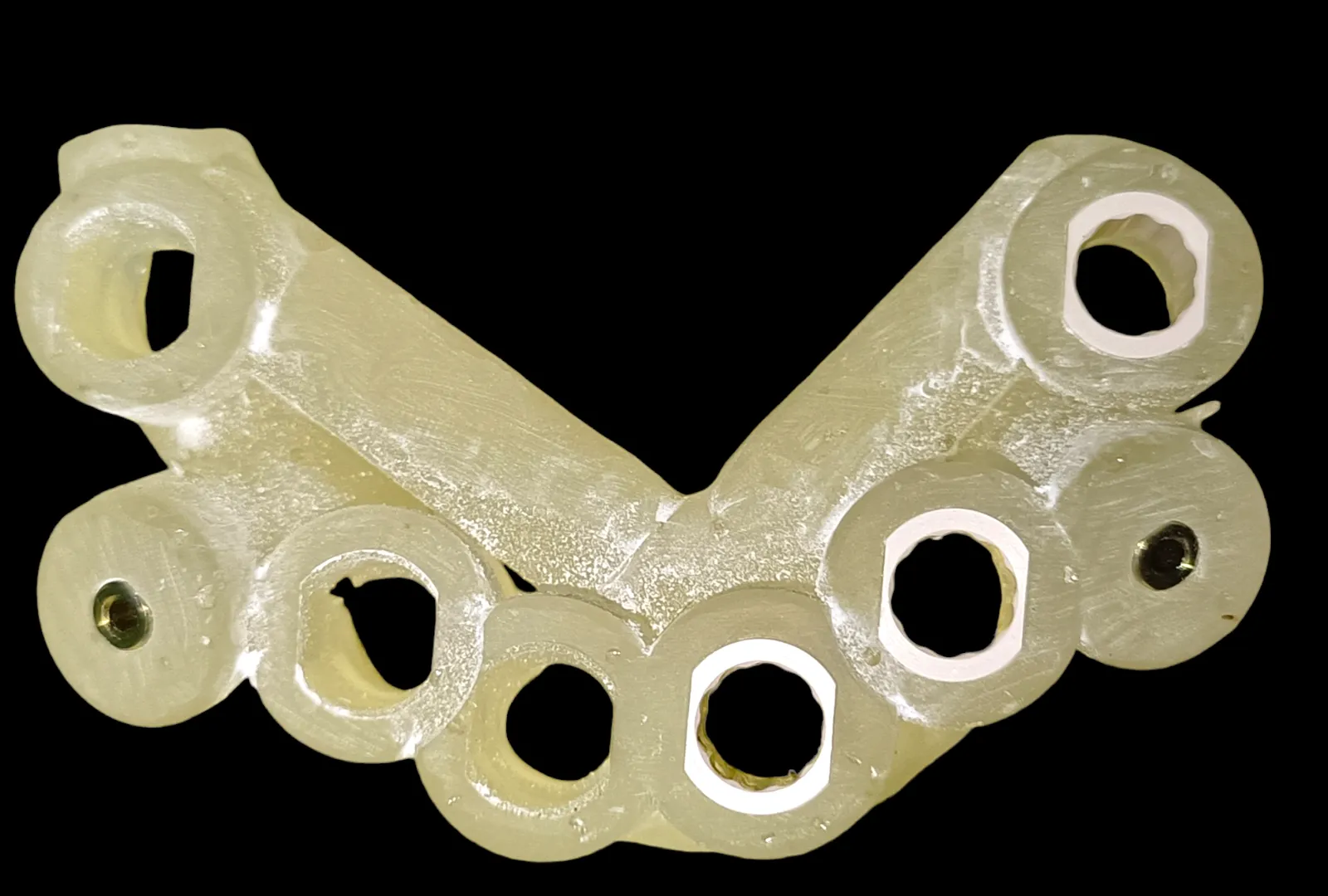 Best Dental Implant technology available today is ...