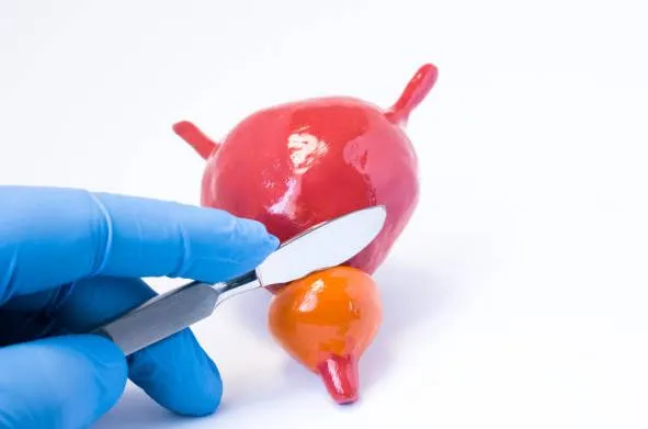 Leading TURP Procedures in Thane Expert Care for P...