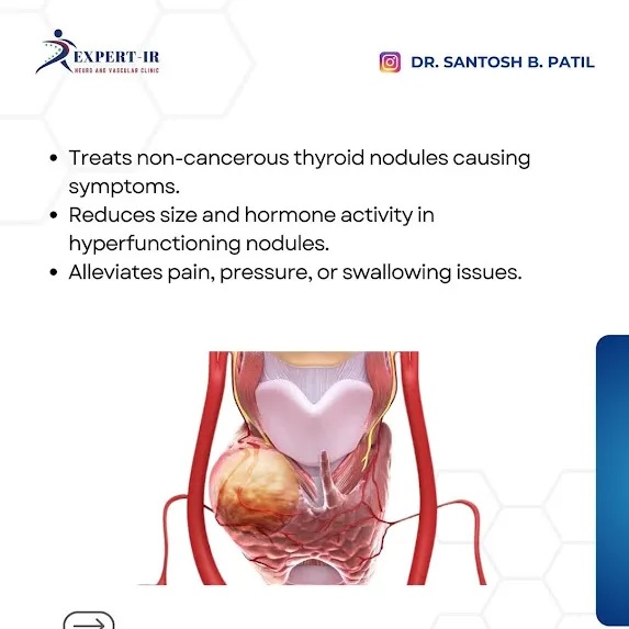 We as Pune’s leading Interventional Radiology cent...