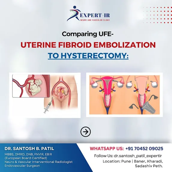 When it comes to treating uterine fibroids, many w...