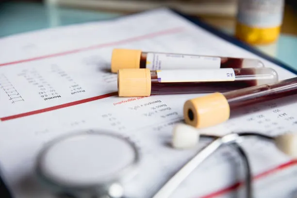 Essential Blood Tests to Maintain Your Health and ...