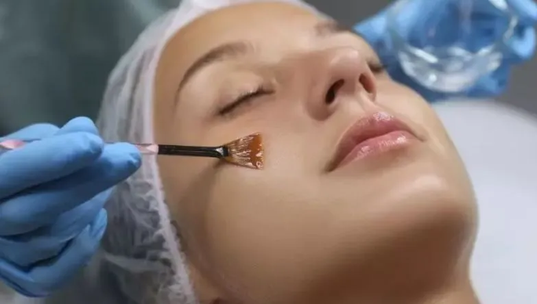 Effective Chemical Peeling Treatments at Gindodia ...
