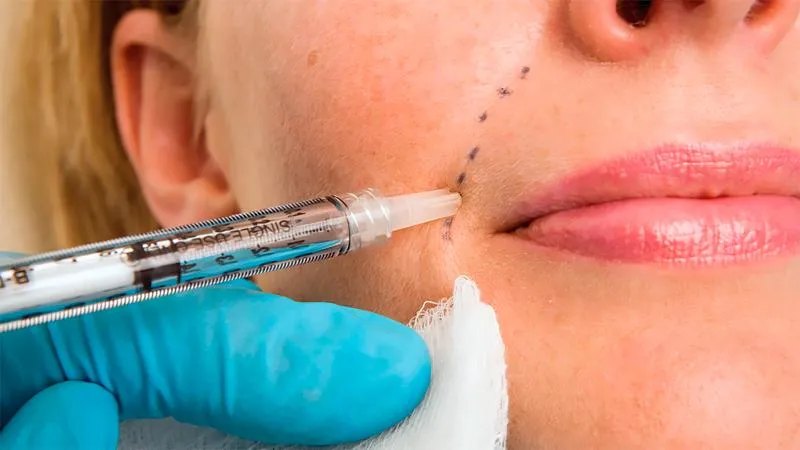 Dermal Fillers in Delhi Dwarka
Rediscover a youth...