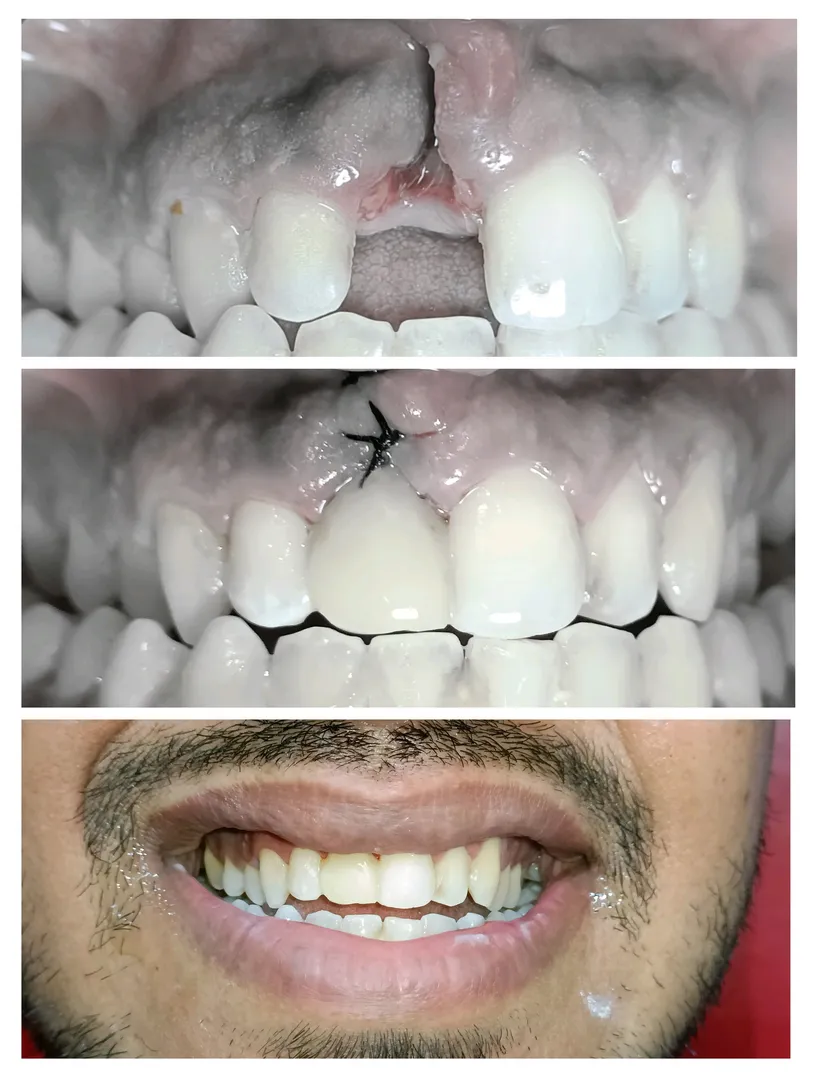 Emergency Dental Care
Imagine you are on a trip a...