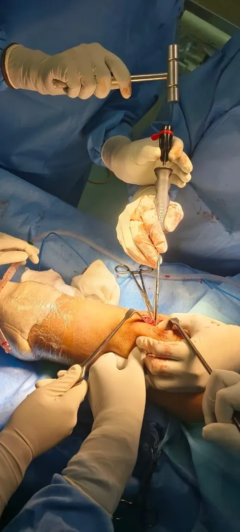 14 years with old girl from Bulandsehr operated su...