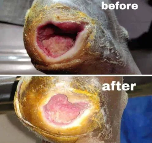 Accelerate Healing with PRP Therapy for Non-Healin...