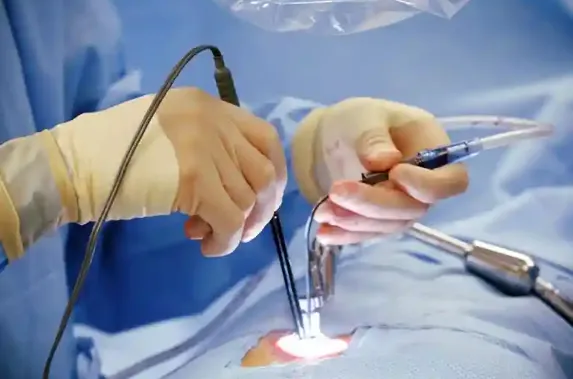 Small Incision Cardiac Surgery in Nagpur: Precisio...