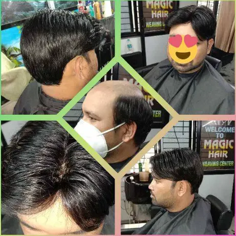 Top Gents Wig Center in Nagpur for Stylish Solutio...