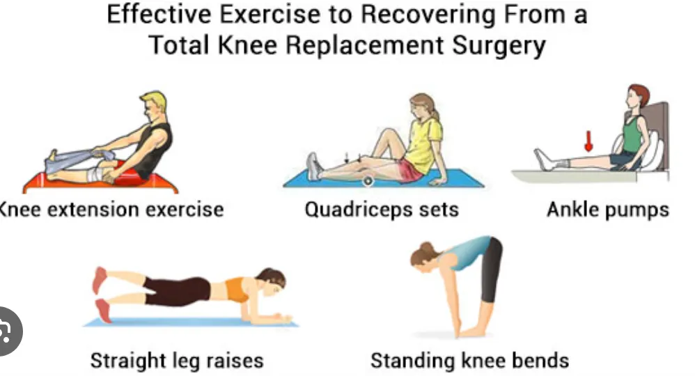 REHABITATION AFTER TOTAL KNEE REPLACEMENT
Rehabil...