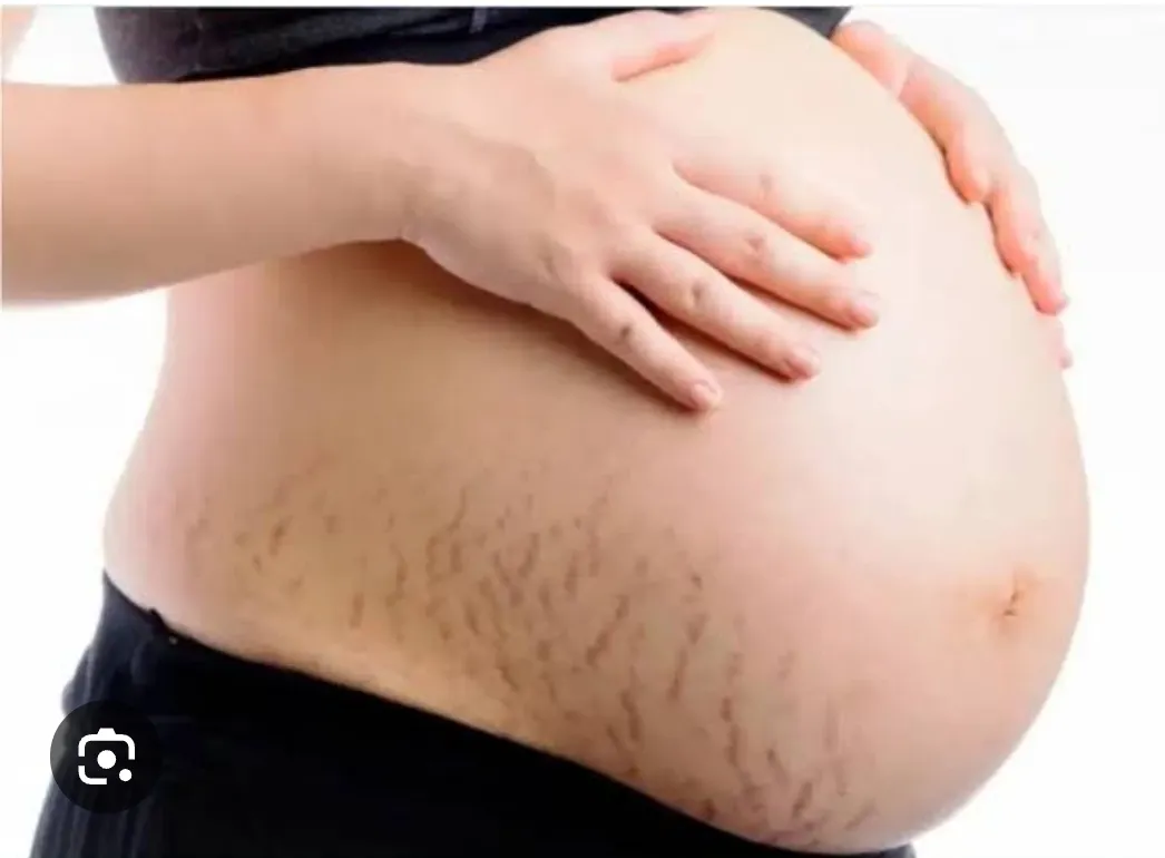 During pregnancy, many women experience changes in...