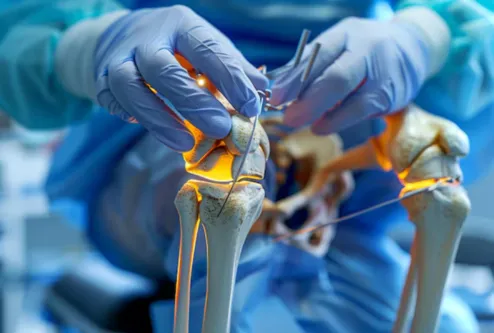 Innovative Arthroscopy Surgery at Anand Orthopaedi...