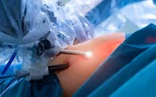 Robotic Surgery Removes Complex Tumour In Newly In...
