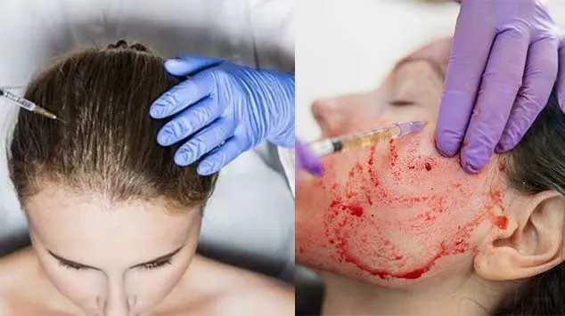 Stem Cell Therapy for Hair and Skin: A Breakthroug...