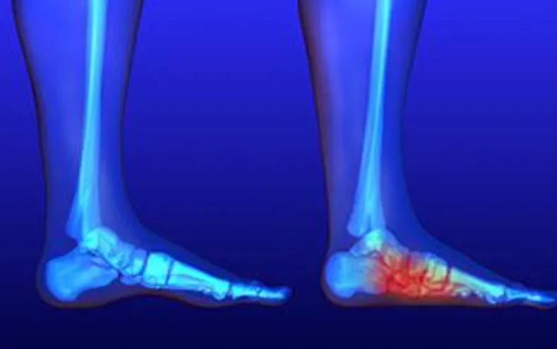 Effective Deformity Correction at Anand Orthopaedi...