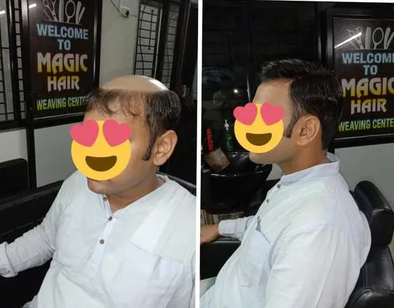 Best Hair Bonding Center in Nagpur Searching for t...