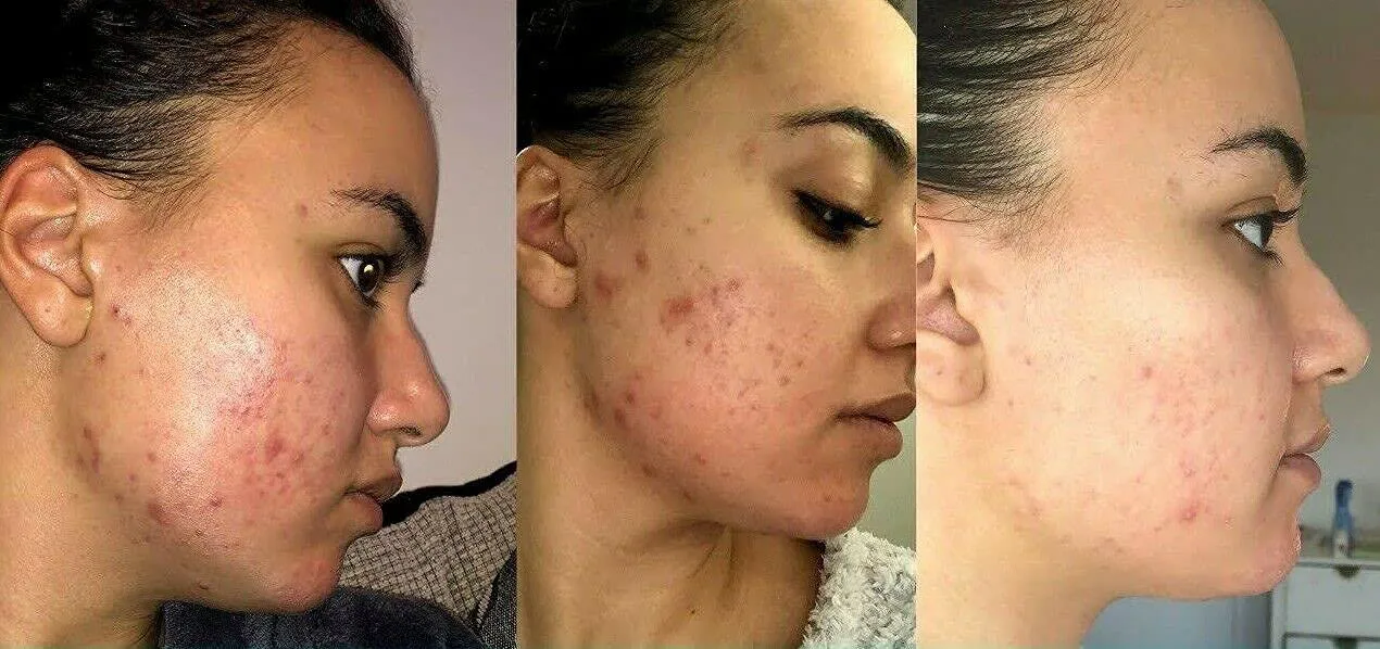 # Best Dermatologist in Kalwa, Thane
# Top Dermat...