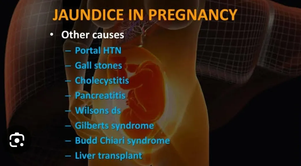Jaundice in pregnancy can occur for several reason...