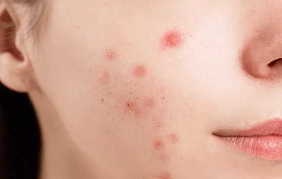 Best Dermatologist in Manisha Nagar Kalwa, Thane
...