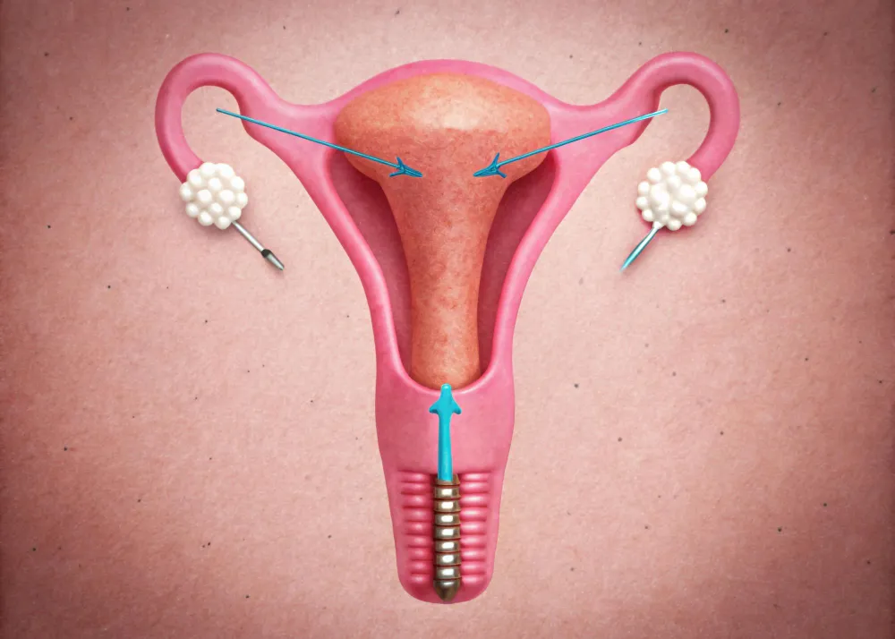 Myomectomy Surgery in Thane For women suffering fr...