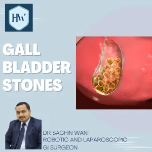 Gallbladder stones is a common problem now-a-days,...