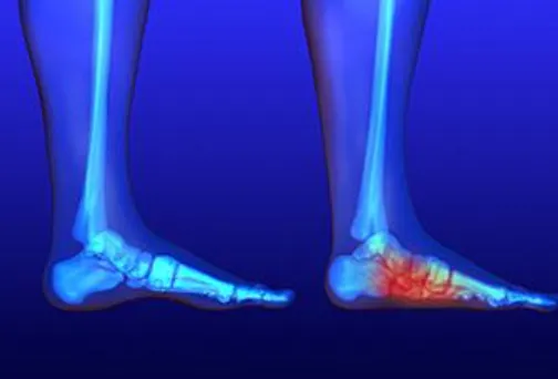 Deformity Correction Services in Pimpri-Chinchwad ...